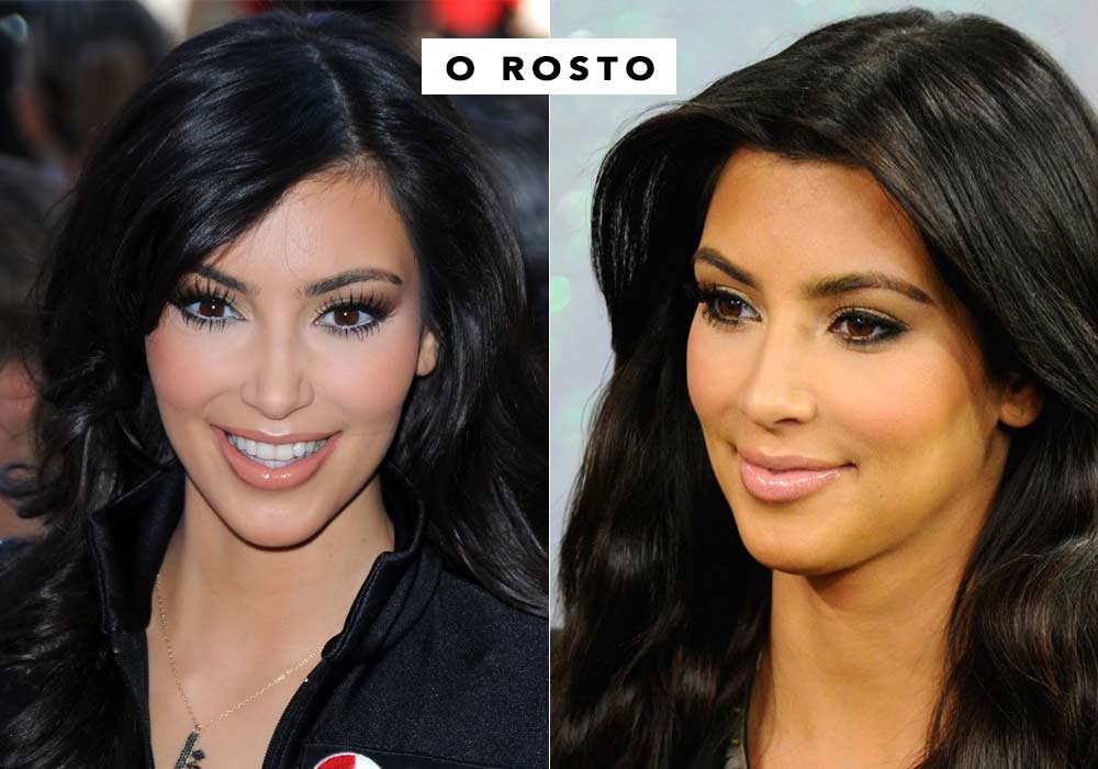 Mudanças no Rosto da Kim Kardashian